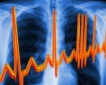 Tăng acid uric máu và bệnh liên quan