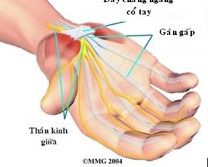 Những nguyên nhân gây tê tay