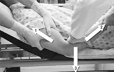 nắn chỉnh trật khớp khuỷu tay