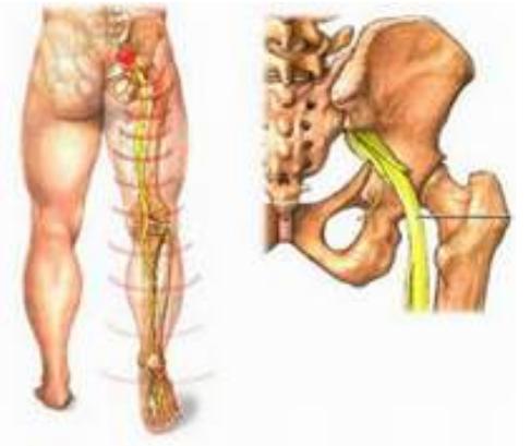 Ðau cột sống thắt lưng và thần kinh tọa