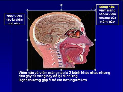 Những điều cần biết về viêm não Nhật Bản