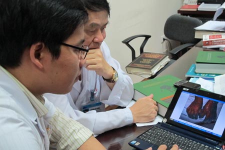Xuất hiện bệnh nhân “ma cà rồng” đầu tiên ở Việt Nam