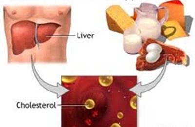Làm gì để phòng ngừa tăng cholesterol máu?