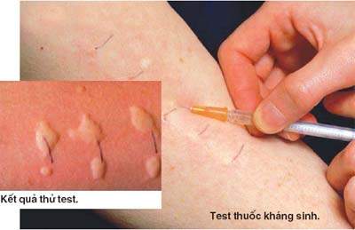 Bệnh do… thuốc