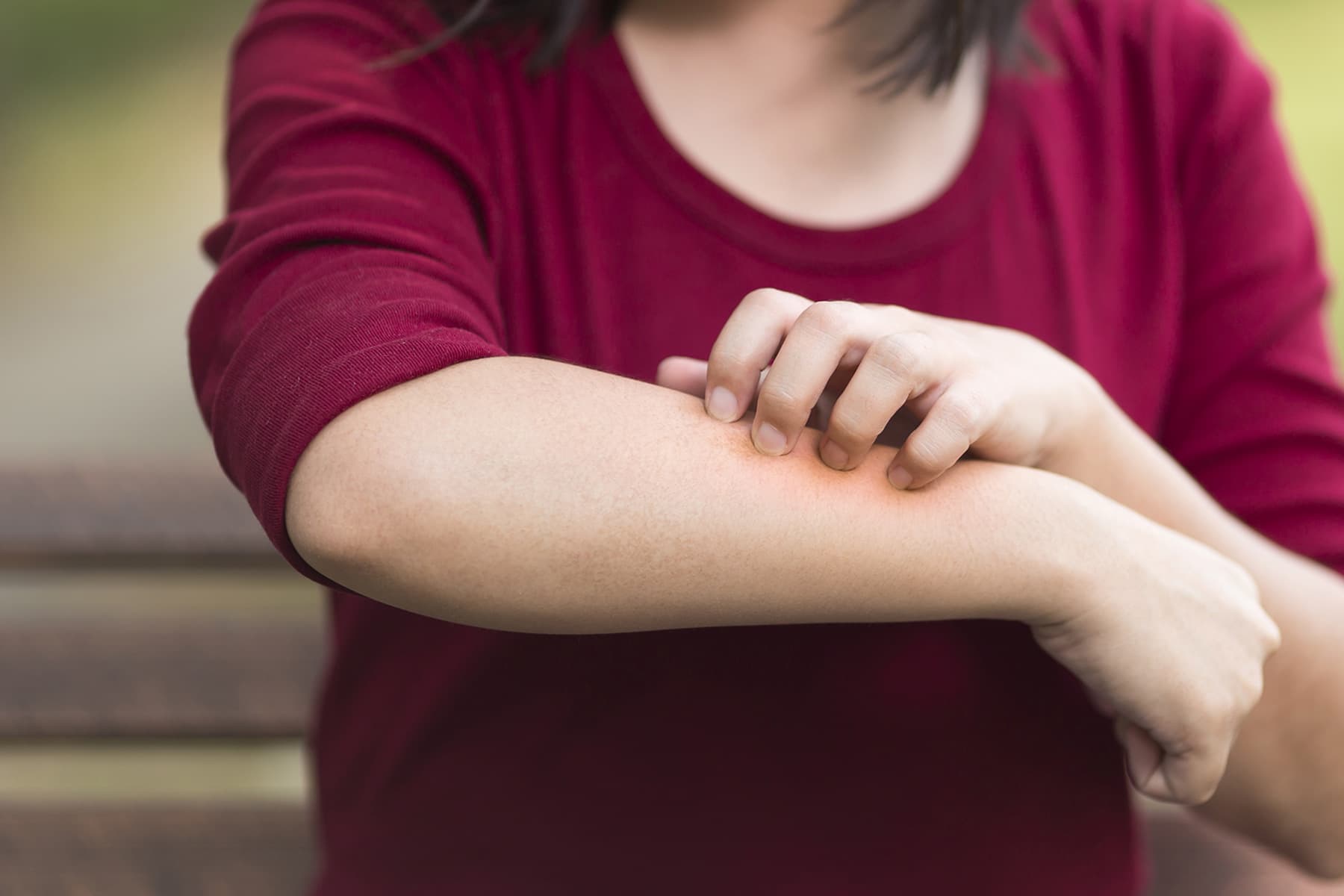 1800x1200_woman_scratching_forearm_other.jpg